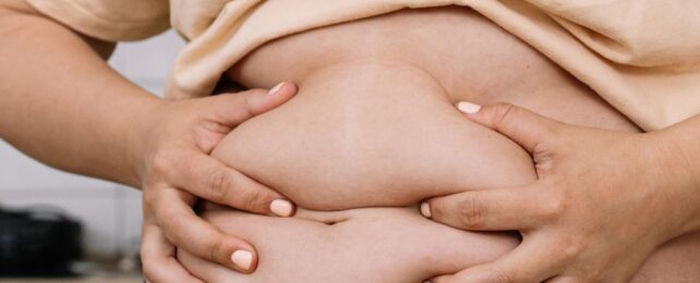 Fat Cells Seem to Cling to The Memory of Being Obese, Study Finds